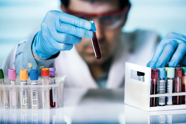 male doctor pulls blood sample from rack