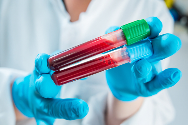medical equipment blood test 4454 medical equipment blood test 4454