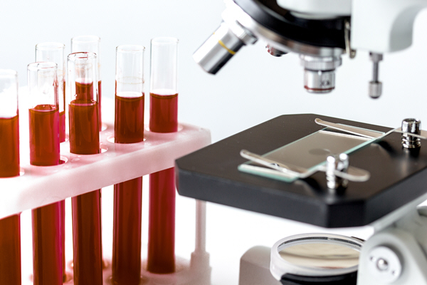 medical equipment blood test in laboratory no one medical equipment blood test in laboratory no one