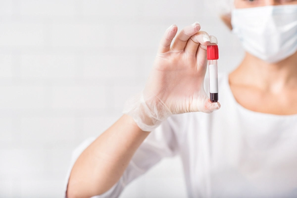 nurse holds blood sample