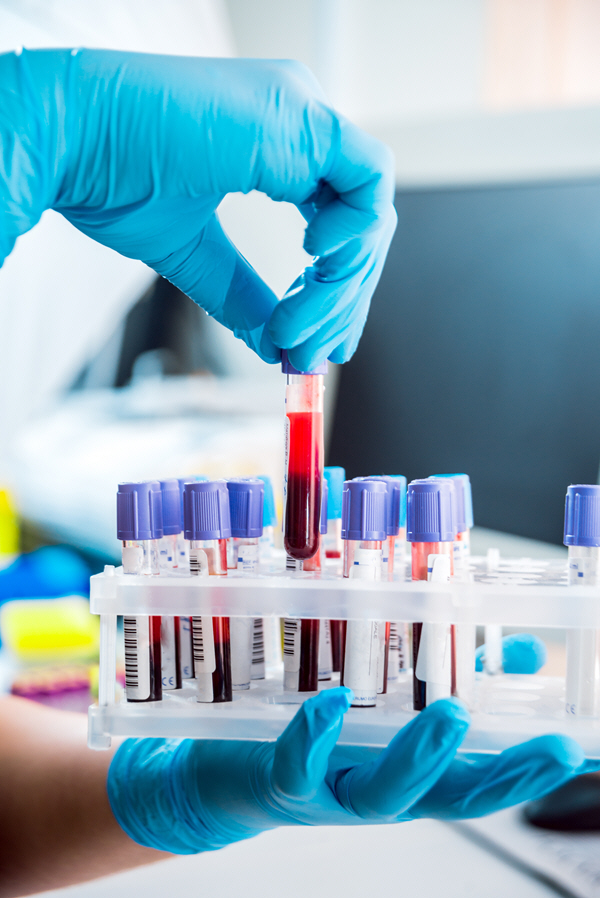 rack of blood samples 2 rack of blood samples 2