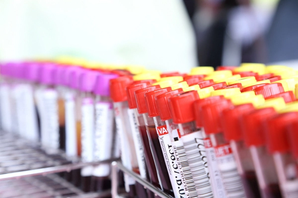 rack of blood samples 3