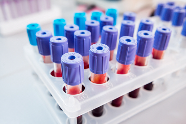rack of blood samples rack of blood samples