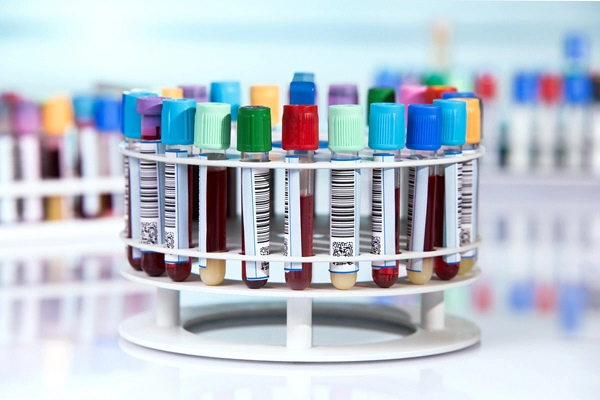 rack of tubes in laboratory 2