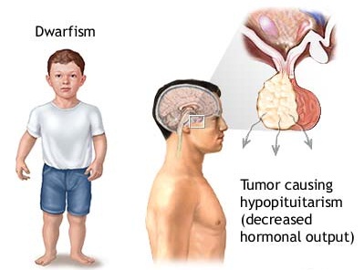 Alternative testosterone replacement therapy