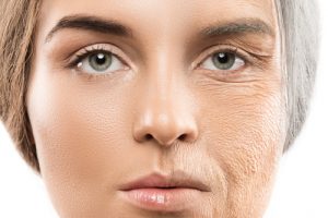 anti aging 300x200